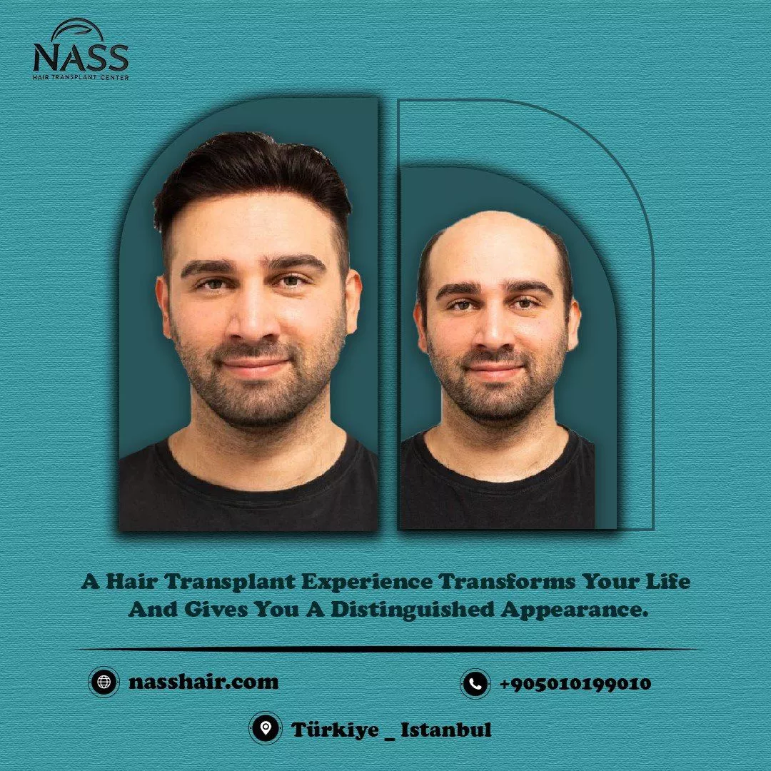 turkey hair transplant